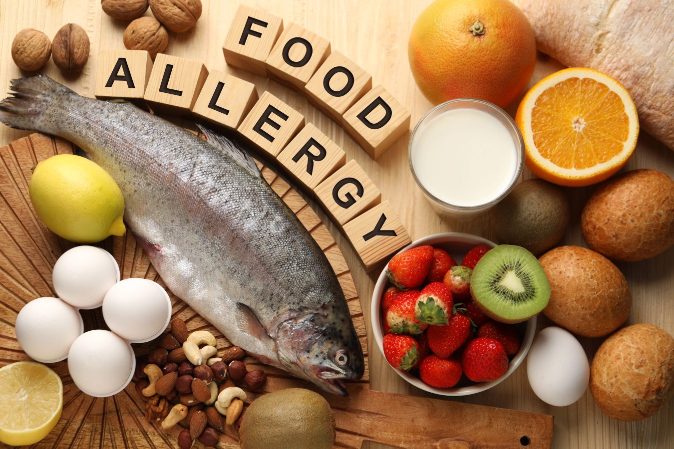 food allergies